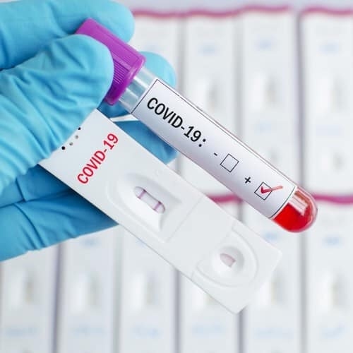 Антигенен тест за Ковид-19 в ДКЦ „Хигия”, цена – 48 лв.